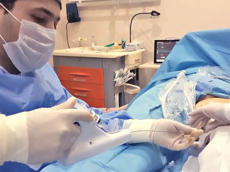 Varicose-vein procedure at the clinic